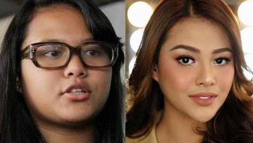 Wajah before dan after aurel hermansyah